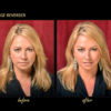 Before and after pictures of Marta looking younger using the face lift band.